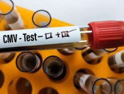 Infeksi Virus CMV dan Dampaknya pada Gejala Autisme pada Anak