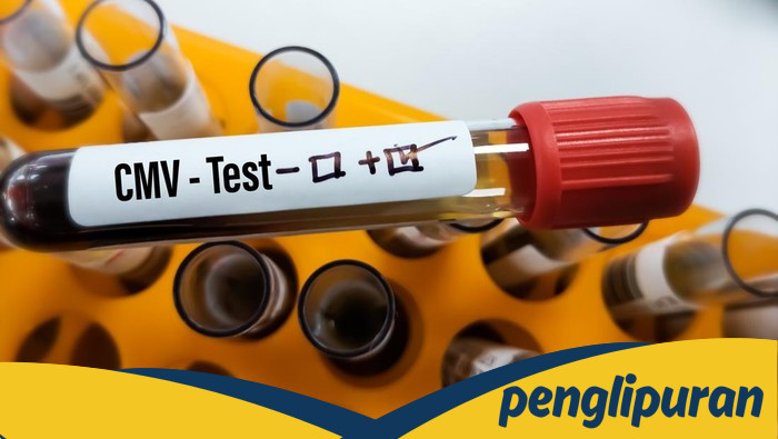Infeksi Virus CMV dan Dampaknya pada Gejala Autisme pada Anak
