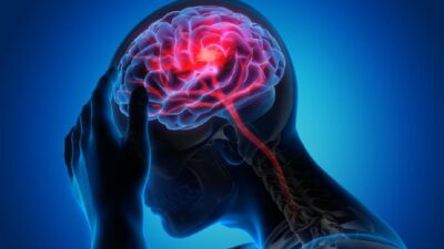 Jika Tidak Ingin Alami Stroke Muda, Jangan Pernah Anggap Sepele Kebiasaan Ini