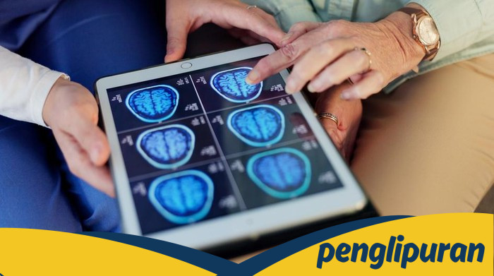 [Kenali Ciri-ciri Penyumbatan Pembuluh Darah di Otak, Jangan Sampai Terlambat]