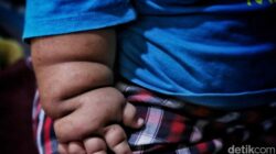 “Mengapa Obesitas Sentral Menjadi Ancaman bagi Generasi Alpha di RI? Kemenkes Beri Peringatan Kritis!”