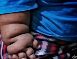 “Mengapa Obesitas Sentral Menjadi Ancaman bagi Generasi Alpha di RI? Kemenkes Beri Peringatan Kritis!”