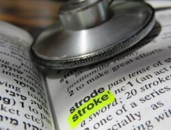 “Perhatikan Ini: Ciri-ciri Stroke pada Wanita yang Sering Dilupakan, Jangan Sampai Menjadi Penyesalan”