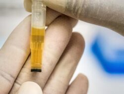 “Cegah Dini, Kenali Ciri-ciri Orang Terkena Kanker Hati dari Urine Anda!”