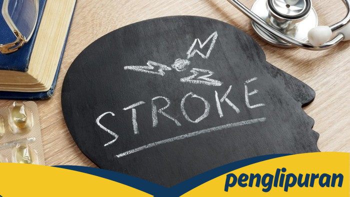 7 Kebiasaan Sederhana, Tak Disangka, yang Mungkin Menyelamatkan Anda dari Stroke!