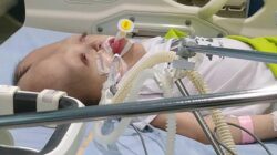 **Dhafita Nizza, Anak 11 Tahun yang Berjuang melawan Hidrosefalus, Epilepsi, dan Cerebral Palsy**