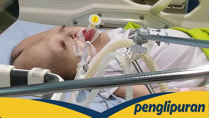 **Dhafita Nizza, Anak 11 Tahun yang Berjuang melawan Hidrosefalus, Epilepsi, dan Cerebral Palsy**