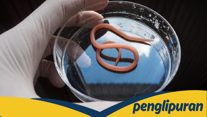 Kemenkes Buka Suara Terkait Balita di Sukabumi Meninggal gegara Kecacingan - Update 1