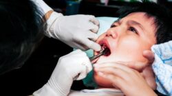 “90% Anak Terkena Karies Gigi! Apa yang Dilakukan IDGAI?”