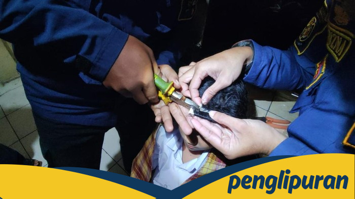 Rambut Siswi TK di Bogor Terlilit Sisir, Ortu Datangi Damkar.