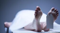 Tragis, Wanita Umur 22 Tewas gegara Alergi saat Jalani CT Scan: Kenali Risiko dan Pencegahannya