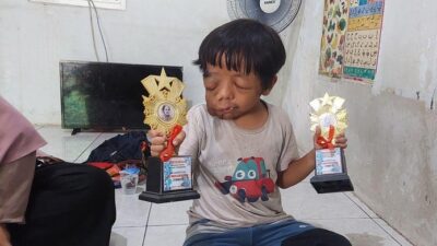“Takdir Mengerikan Ilyas: Penderita Tumor Getah Bening yang Terus Dilupakan”