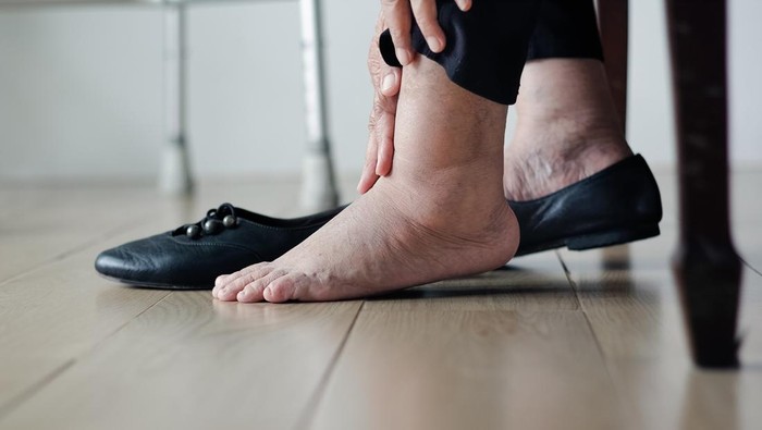 Waspadai! 5 Tanda-Tanda Jantung dan Liver Bermasalah yang Tersembunyi di Kaki Anda