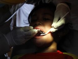 “Kemenkes Ungkap Separuh Warga Indonesia Mengeluh Sakit Gigi, Tapi Ogah Periksa”
