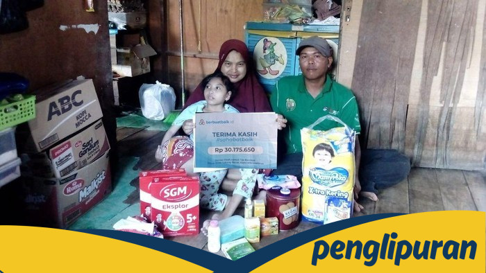 **Anak Tukang Becak, Apriliana, Terlantar dengan Mikrosepalus: Sahabat Baik Bantu Kebutuhannya**