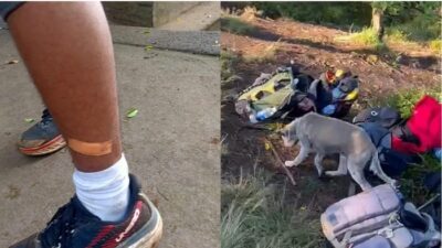 15 Pendaki Gunung di Bali Digigit Anjing Liar, Suntik Anti Rabies Jadi Solusi Darurat!