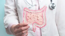 Warga RI Dihantui Penyakit Kanker Usus Besar, Dokter Ungkap Alasannya: Kenapa Ini Menjadi Krisis Kesehatan?