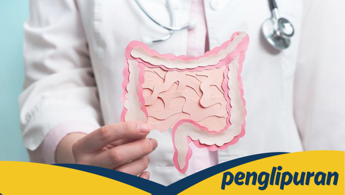 Warga RI Dihantui Penyakit Kanker Usus Besar, Dokter Ungkap Alasannya: Kenapa Ini Menjadi Krisis Kesehatan?