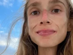 Kronologi Wanita yang Meninggal Karena Diet Ekstrem, Hanya Makan Buah: Sebuah Pengingat Tentang Pentingnya Gizi Seimbang