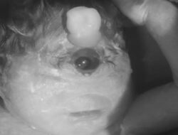 “Bayi Ini Dengan kondisi Langka, Cuma Bertahan 6 Jam: Kisah Tragis yang Menggetarkan Hati”