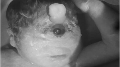 “Bayi Ini Dengan kondisi Langka, Cuma Bertahan 6 Jam: Kisah Tragis yang Menggetarkan Hati”