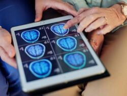“Neurolog: 5 Kebiasaan Sehari-hari yang Rupanya Merusak Otak Anda Tanpa Disadari”