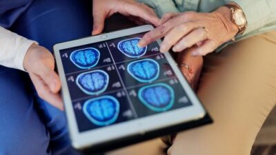 “Neurolog: 5 Kebiasaan Sehari-hari yang Rupanya Merusak Otak Anda Tanpa Disadari”