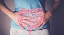 Dokter Harvard Beberkan 8 Gejala Kanker Usus Besar yang Sering Dikesampingkan Pasien