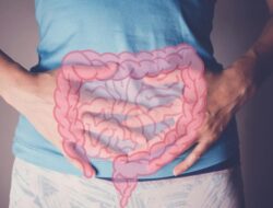 Dokter Harvard Beberkan 8 Gejala Kanker Usus Besar yang Sering Dikesampingkan Pasien