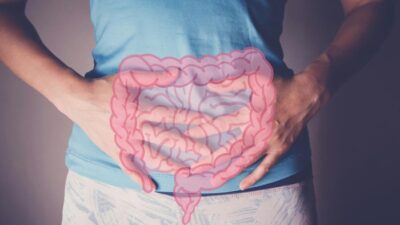 Dokter Harvard Beberkan 8 Gejala Kanker Usus Besar yang Sering Dikesampingkan Pasien