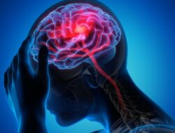 **Orang Muda Juga Rentan Stroke, Kenali Gejala dan Faktor Risiko yang Perlu Dihindari**