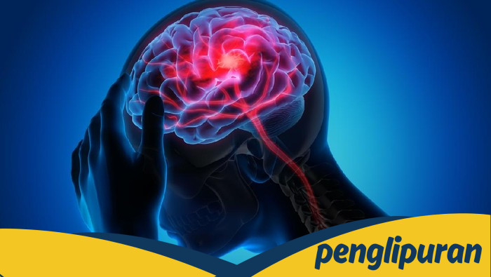 **Orang Muda Juga Rentan Stroke, Kenali Gejala dan Faktor Risiko yang Perlu Dihindari**