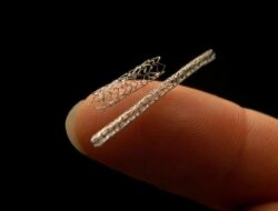 Apakah Semua Pasien Sakit Jantung Harus Pasang Ring? Penjelasan Ahli Kesehatan