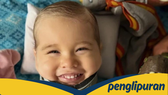 Bak Mukjizat, Kepala Balita Terpisah dari Tulang Belakang Bisa Disambung Lagi: Kisah Medis yang Mengguncang Dunia!