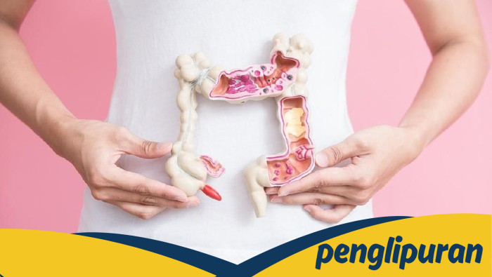 Sumbatan Usus Berbahaya: Dokter Beberkan Fakta yang Bisa Jadi Penyebab Kematian!