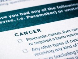 **Dokter Luruskan Mitos Biopsi: Ini Faktanya Tentang Kanker**