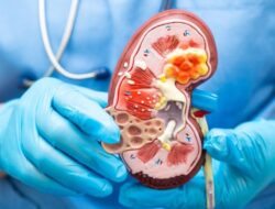 **Perubahan Warna Urine yang Menandakan Gagal Ginjal dan Pentingnya Deteksi Dini**