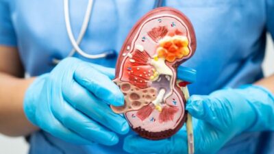 **Perubahan Warna Urine yang Menandakan Gagal Ginjal dan Pentingnya Deteksi Dini**