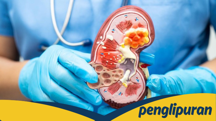 **Perubahan Warna Urine yang Menandakan Gagal Ginjal dan Pentingnya Deteksi Dini**