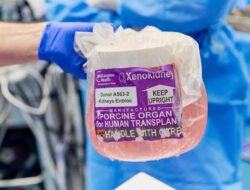 **Dokter Bedah AS Uji Klinis Ginjal Babi Hasil Edit Gen untuk Menyelamatkan Nyawa Manusia**