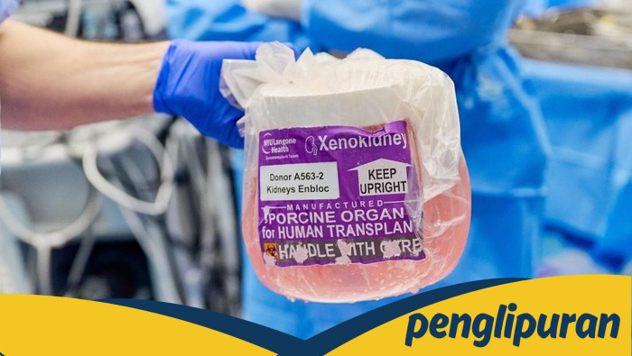 **Dokter Bedah AS Uji Klinis Ginjal Babi Hasil Edit Gen untuk Menyelamatkan Nyawa Manusia**
