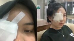 Efek Berbahaya Kosmetik Pinkflash: Iritasi Mata hingga Operasi dan Peringatan BPOM RI