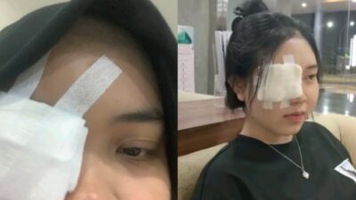 Efek Berbahaya Kosmetik Pinkflash: Iritasi Mata hingga Operasi dan Peringatan BPOM RI