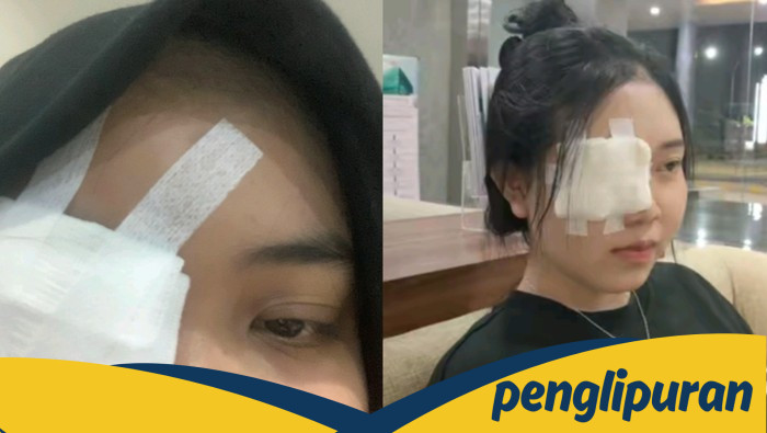 Efek Berbahaya Kosmetik Pinkflash: Iritasi Mata hingga Operasi dan Peringatan BPOM RI