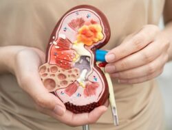 6 Makanan-Minuman yang Dapat Merusak Ginjal dan Tips Menjaganya