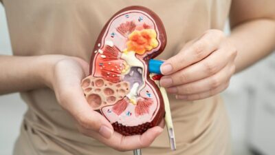 6 Makanan-Minuman yang Dapat Merusak Ginjal dan Tips Menjaganya