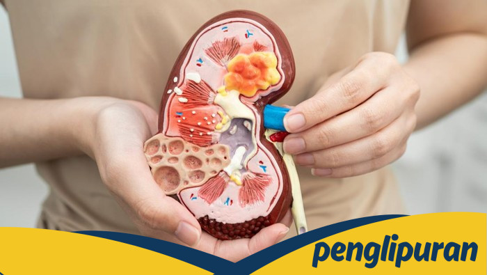 6 Makanan-Minuman yang Dapat Merusak Ginjal dan Tips Menjaganya