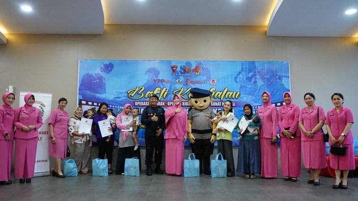 **Peringati HUT ke-80, Brimob Gelar Operasi Bibir Sumbing Gratis untuk 21 Anak dari 3 Daerah**