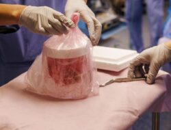 Peneliti AS Semakin Dekat Wujudkan Transplantasi Ginjal Babi untuk Manusia – Update 1