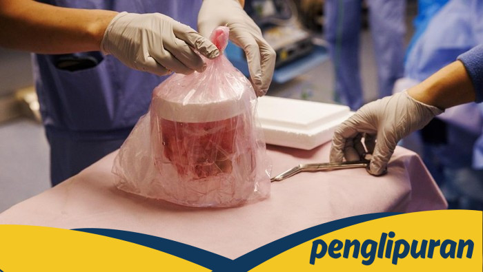 Peneliti AS Semakin Dekat Wujudkan Transplantasi Ginjal Babi untuk Manusia - Update 1